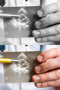 Cardiovascular Ultrasound